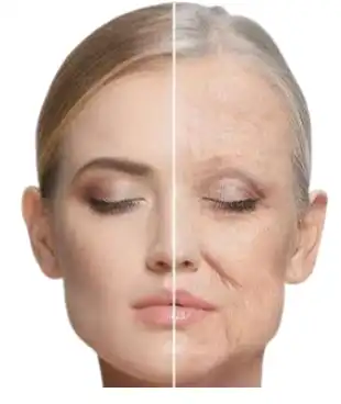 antioxidation antioxidation