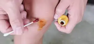 iodine crystals powder Diverse Application Fields